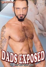 Dads Exposed