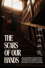 The Scars of Our Hands