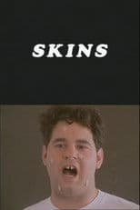 Skins