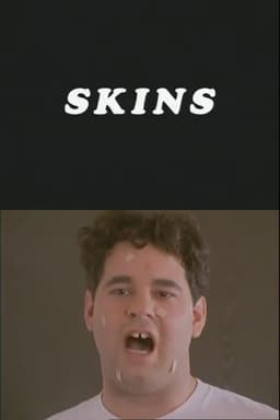Skins