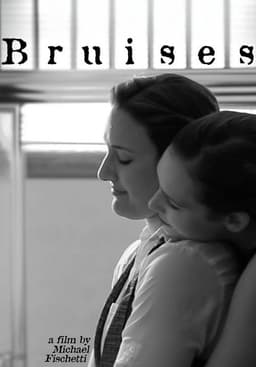Bruises